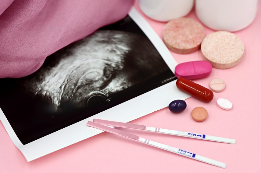 PCOS Symptoms Treatment: Diagnosis & Management Guide 2026