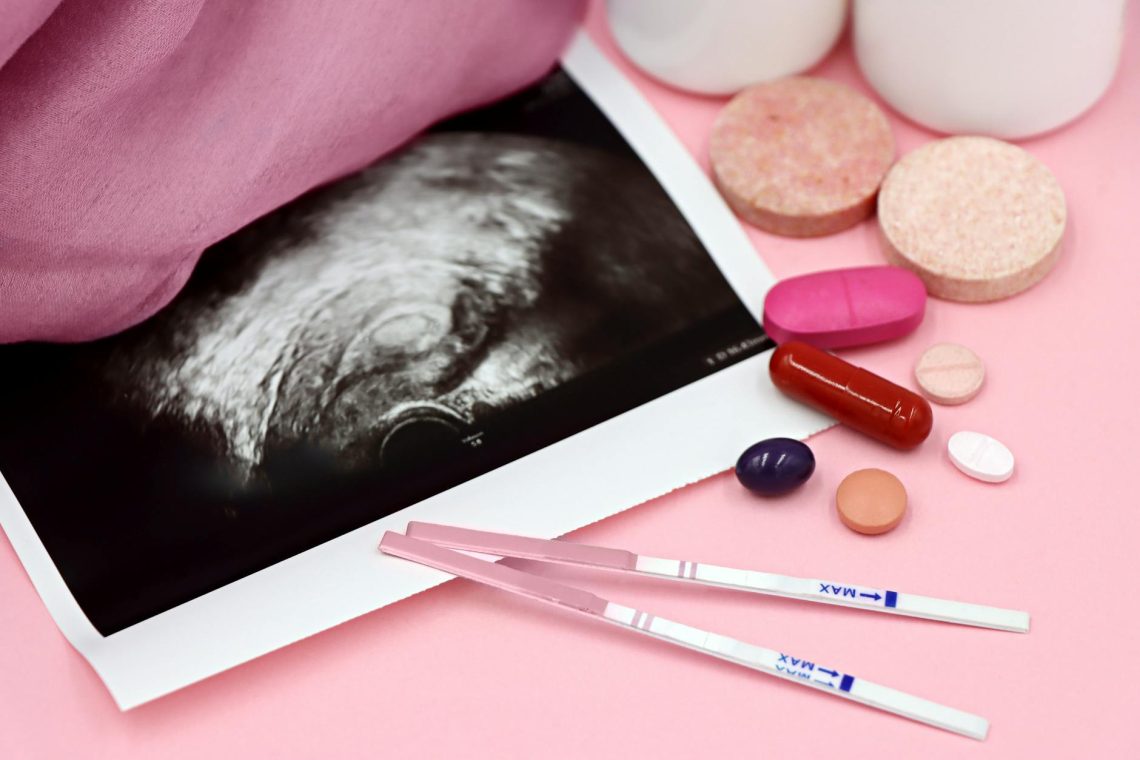 PCOS Symptoms Treatment: Diagnosis & Management Guide 2026