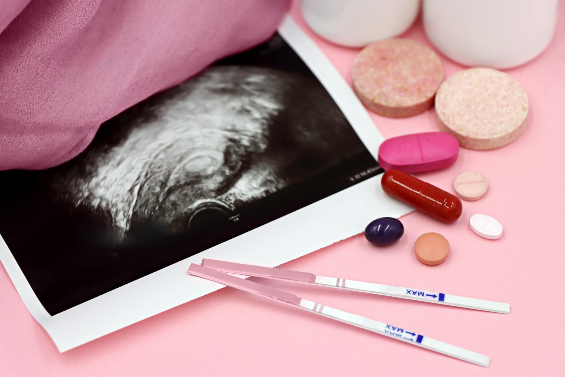 PCOS Symptoms Treatment: Diagnosis & Management Guide 2026